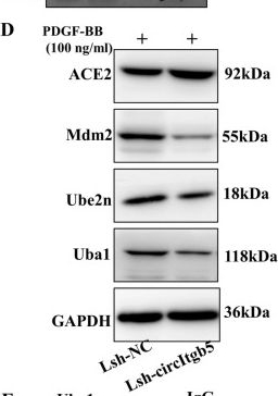 Fig.7.D showing Western Blotting in a Rattus norvegicus (Rat) sample from the publication: CircItgb5 promotes synthetic phenotype of pulmonary artery smooth muscle cells via interacting with miR-96-5p and Uba1 in monocrotaline-induced pulmonary arterial hypertension.