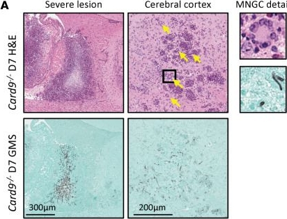 Fig.5.A showing Immunohistochemistry in a Mus musculus (House mouse) sample from the publication: A CARD9 deficiency mouse model recapitulates human chronic CNS candidiasis identifying defective monocytic cell responses in immunopathogenesis.