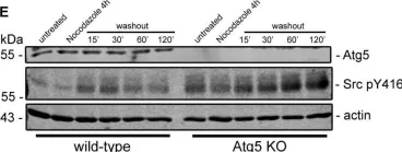 Fig.7.E showing Western Blotting in a Homo sapiens (Human) sample from the publication: Loss of the Essential Autophagy Regulators FIP200 or Atg5 Leads to Distinct Effects on Focal Adhesion Composition and Organization.