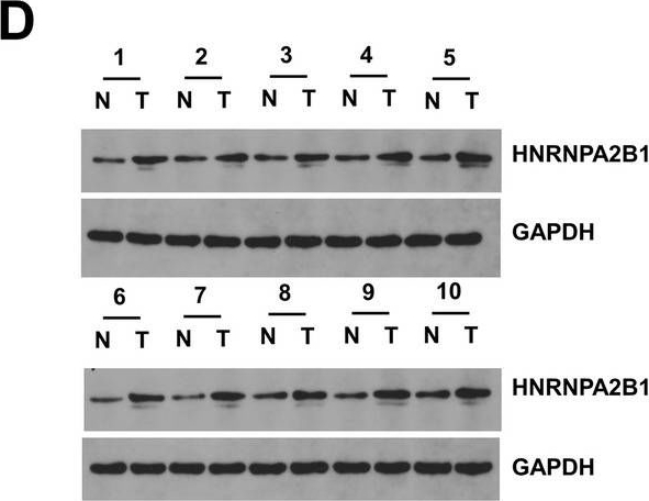 Fig.1.D showing Western Blotting in a Homo sapiens (Human) sample from the publication: HNRNPA2B1-mediated m6A modification of lncRNA MEG3 facilitates tumorigenesis and metastasis of non-small cell lung cancer by regulating miR-21-5p/PTEN axis.