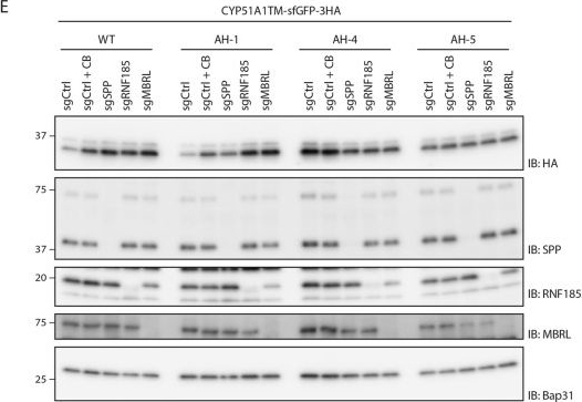 Fig.5.E showing Western Blotting in a Homo sapiens (Human) sample from the publication: Topology surveillance of the lanosterol demethylase CYP51A1 by signal peptide peptidase.
