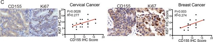 Fig.2.C showing Immunohistochemistry from the publication: CD155-based chimeric antigen receptor T cells: a promising immunotherapy for cervical and breast cancer.
