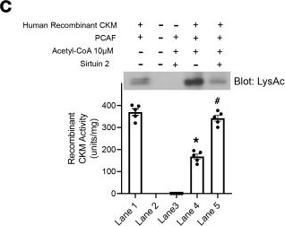 Fig.2.C from the publication: Acetylation of muscle creatine kinase negatively impacts high-energy phosphotransfer in heart failure.