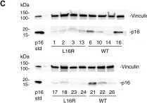 Fig.4.C showing Western Blotting from the publication: A rare germline CDKN2A variant (47T>G; p16-L16R) predisposes carriers to pancreatic cancer by reducing cell cycle inhibition.