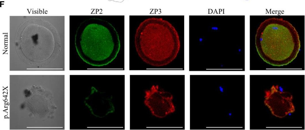 Fig.1.F showing Immunocytochemistry in a Rattus norvegicus (Rat) sample from the publication: Identification of zona pellucida defects revealed a novel loss-of-function mutation in ZP2 in humans and rats.