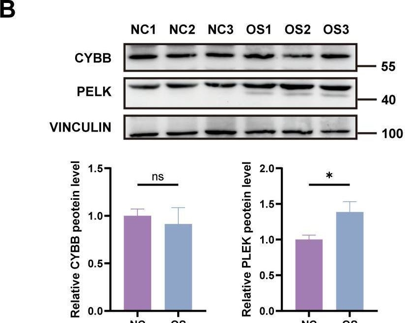 Fig.7.B showing Western Blotting from the publication: The osteosarcoma immune microenvironment in progression: PLEK as a prognostic biomarker and therapeutic target.