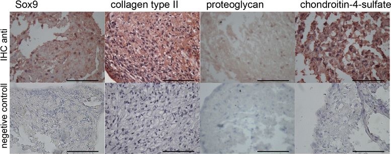 Fig.4.A showing Immunohistochemistry in a Homo sapiens (Human) sample from the publication: Abrasion arthroplasty increases mesenchymal stem cell content of postoperative joint effusions.