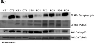 Fig.5.B showing Western Blotting from the publication: Differential protein expression in diverse brain areas of Parkinson's and Alzheimer's disease patients.