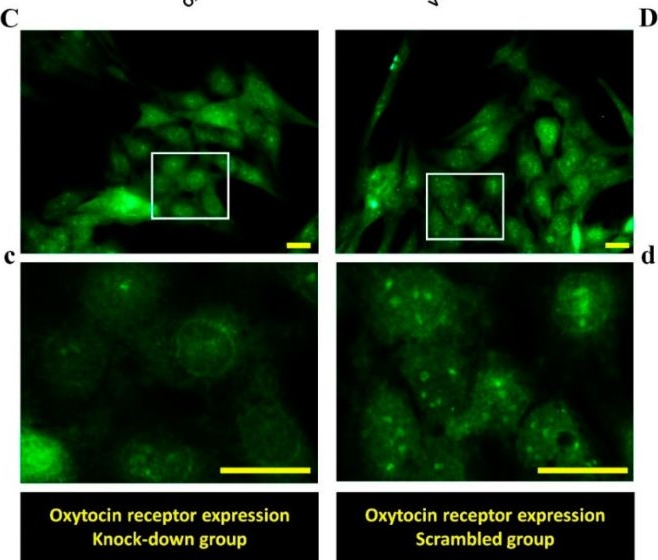 Fig.6.C showing Immunocytochemistry-immunofluorescence from the publication: Co-Stimulation of Oxytocin and Arginine-Vasopressin Receptors Affect Hypothalamic Neurospheroid Size.