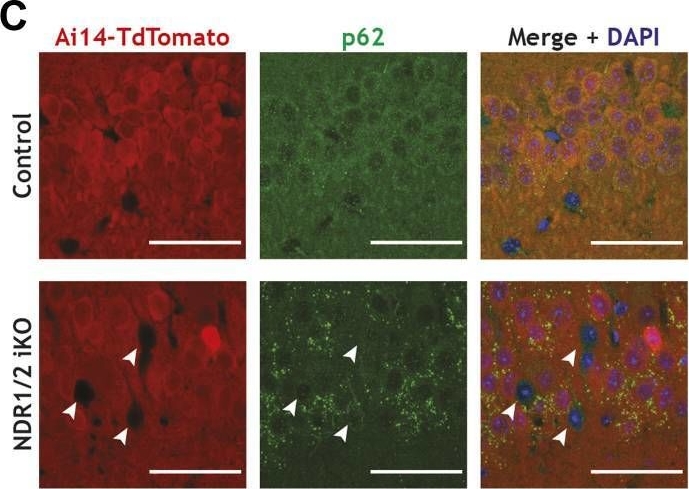 Loss of NDR1/2 kinases impairs endomembrane trafficking and autophagy leading to neurodegeneration.