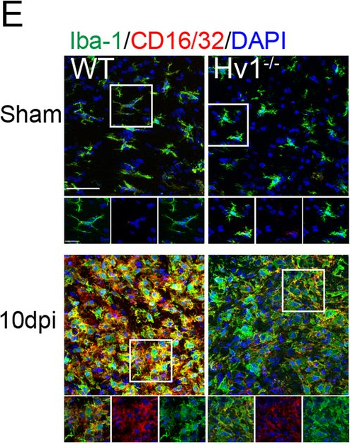 Fig.2.E showing Immunohistochemistry in a Mus musculus (House mouse) sample from the publication: Deficiency of microglial Hv1 channel is associated with activation of autophagic pathway and ROS production in LPC-induced demyelination mouse model.