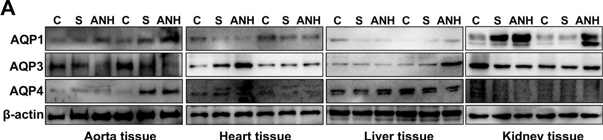 Fig.4.A showing Western Blotting from the publication: Acute Normovolemic Hemodilution Changes the Aquaporin Expression Profile in Specific Tissues and Induces Apoptotic and Inflammatory Processes in a Rat Model.
