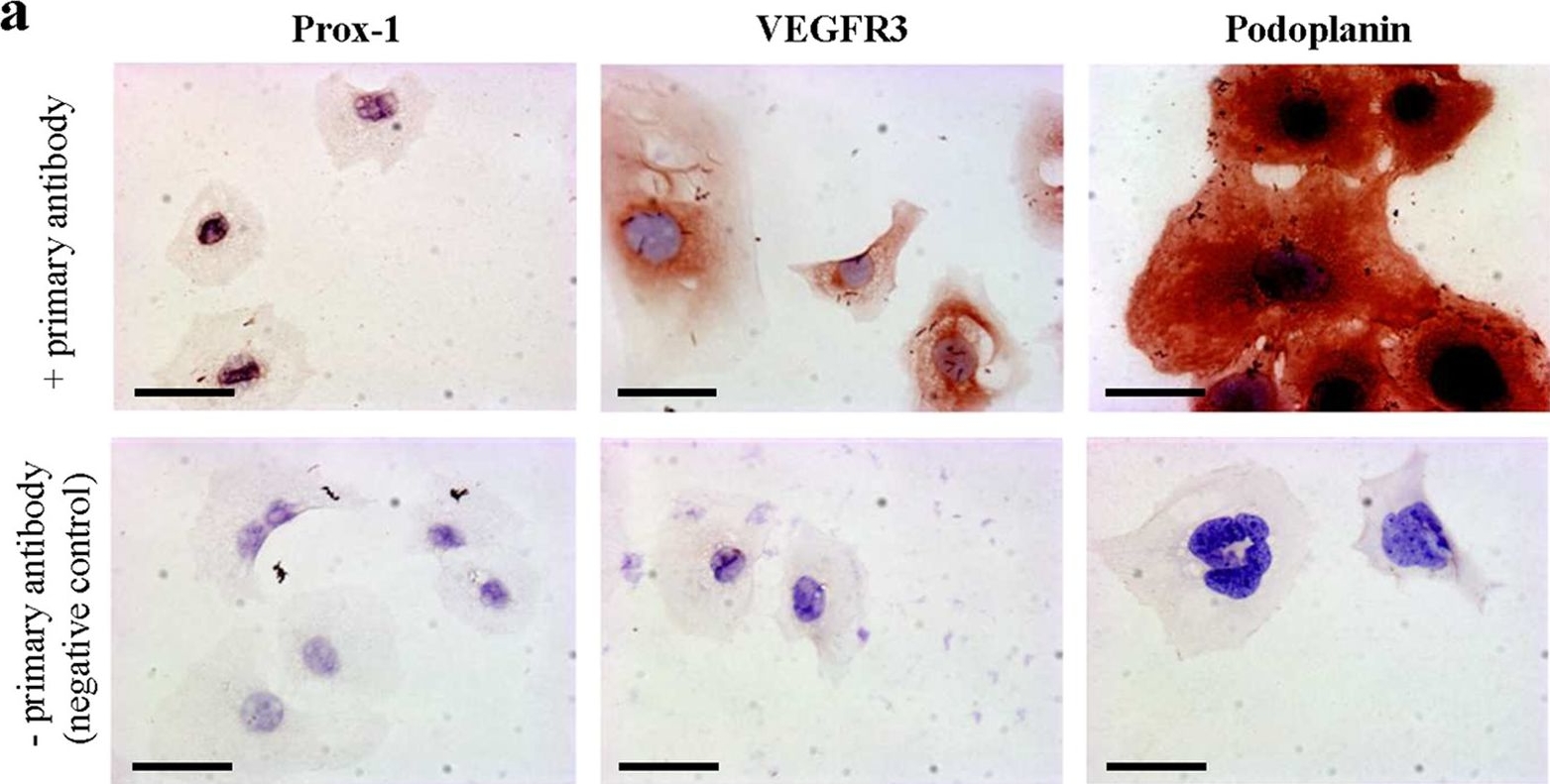 Fig.1.A showing Immunohistochemistry in a Mus musculus (House mouse) sample from the publication: Vitamin D inhibits lymphangiogenesis through VDR-dependent mechanisms.