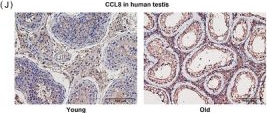 Fig.4.J showing Immunohistochemistry from the publication: Spatiotemporal mapping reveals Ccl8hi macrophages as key drivers of testicular inflammaging.