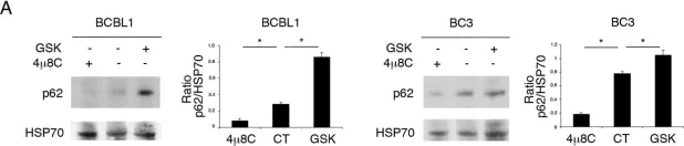 Fig.3.A showing Western Blotting from the publication: IRE1 Alpha/XBP1 Axis Sustains Primary Effusion Lymphoma Cell Survival by Promoting Cytokine Release and STAT3 Activation.