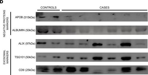 Fig.2.D showing Western Blotting in a Homo sapiens (Human) sample from the publication: Proteomic profiles of peritoneal fluid-derived small extracellular vesicles correlate with patient outcome in ovarian cancer.