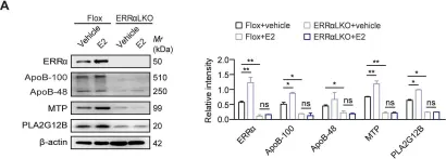 Fig.4.A showing Western Blotting from the publication: Dysfunction of estrogen-related receptor alpha-dependent hepatic VLDL secretion contributes to sex disparity in NAFLD/NASH development.