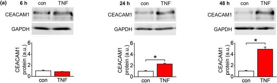 Fig.8.A showing Western Blotting in a Homo sapiens (Human) sample from the publication: Vascular inflammaging: Endothelial CEACAM1 expression is upregulated by TNF-α via independent activation of NF-κB and β-catenin signaling.
