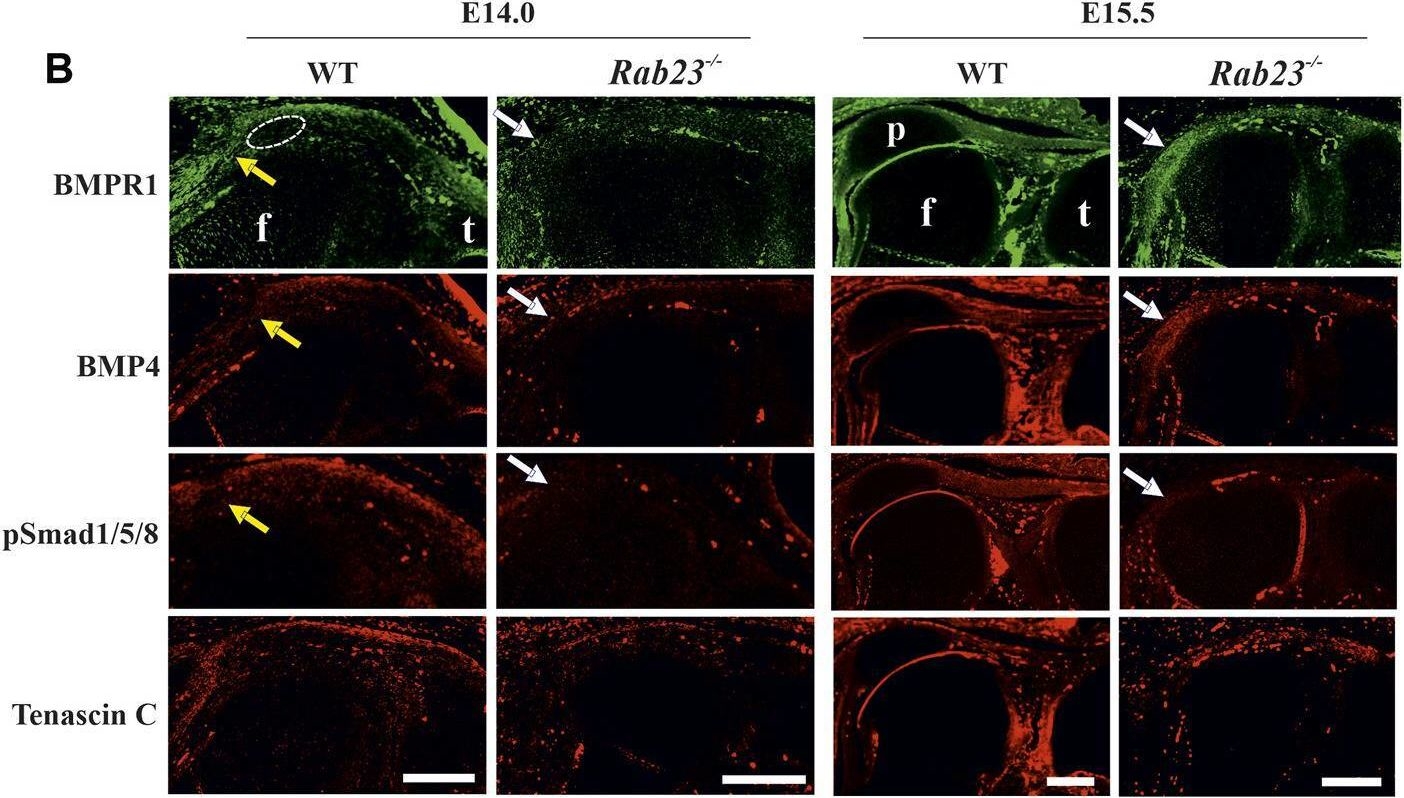 Fig.5.B showing Immunohistochemistry-immunofluorescence in a Mus musculus (House mouse) sample from the publication: RAB23 regulates musculoskeletal development and patterning.