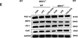 Fig.5.E showing Western Blotting from the publication: α7nAChR agonist GTS-21 ameliorates sepsis-induced acute kidney injury via MEF2/PGC-1α/HO-1 axis in mice.