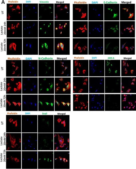 Fig.1.A showing Immunocytochemistry-immunofluorescence in a Homo sapiens (Human) sample from the publication: Lactate Is a Major Promotor of Breast Cancer Cell Aggressiveness.