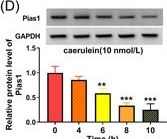 Fig.5.D showing Western Blotting in a Mus musculus (House mouse) sample from the publication: Mmu_circ_0000037 inhibits the progression of acute pancreatitis by miR-92a-3p/Pias1 axis.