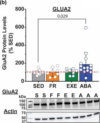 Fig.2.B showing Western Blotting in a Mus musculus (House mouse) sample from the publication: Activity-based anorexia enhances glutamatergic synaptic transmission and neuronal excitability within the nucleus accumbens of female mice.