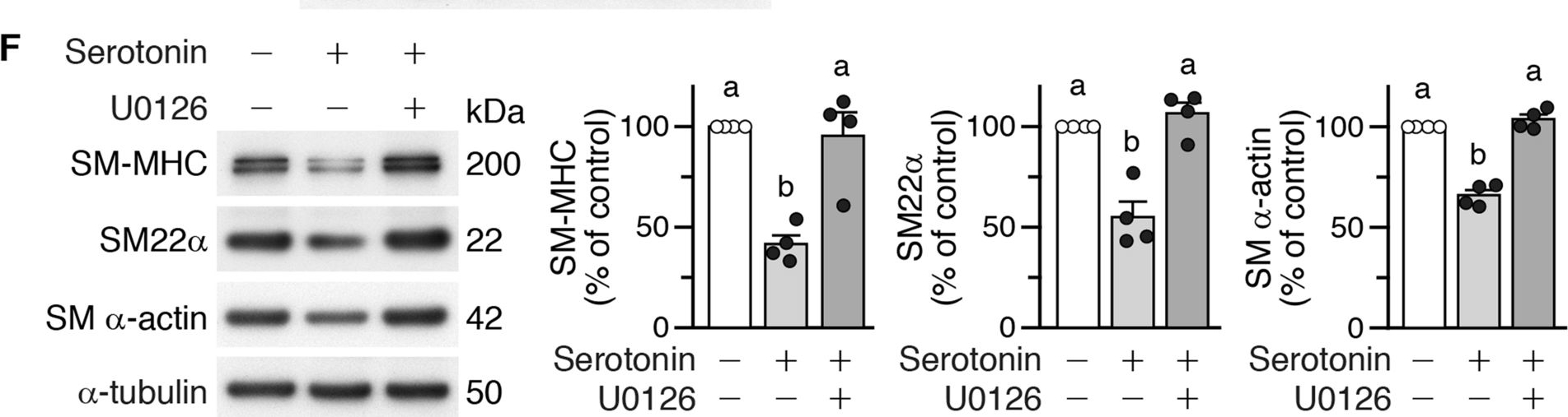 Fig.6.F showing Western Blotting in a Mus musculus (House mouse) sample from the publication: Smooth muscle-specific expression of hydroxyindole O-methyltransferase reduces arterial injury-induced intimal hyperplasia.