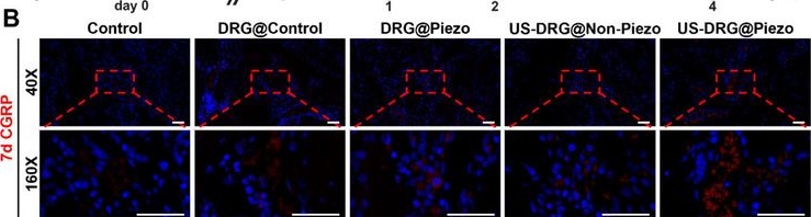 Fig.6.B showing Immunohistochemistry-immunofluorescence in a Rattus norvegicus (Rat) sample from the publication: Bioinspired Engineering of Streamlined Skeletal Interoception: Neural Bioprinted Piezoelectric Scaffolds for Neuro-Vascularized Bone Regeneration.