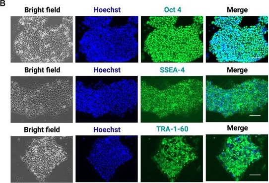 Fig.1.B showing Immunocytochemistry-immunofluorescence in a Homo sapiens (Human) sample from the publication: Skeletal muscle cell protein dysregulation highlights the pathogenesis mechanism of myopathy-associated p97/VCP R155H mutations.
