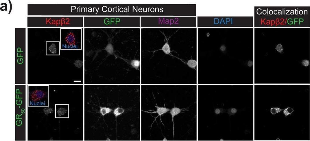 Fig.2.A showing Immunocytochemistry-immunofluorescence from the publication: The nuclear import receptor Kapβ2 modifies neurotoxicity mediated by poly(GR) in C9orf72-linked ALS/FTD.
