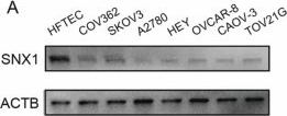 Fig.3.A showing Western Blotting in a Homo sapiens (Human) sample from the publication: SNX1 inhibits human ovarian cancer progression via regulation of the cell cycle, apoptosis and migration.