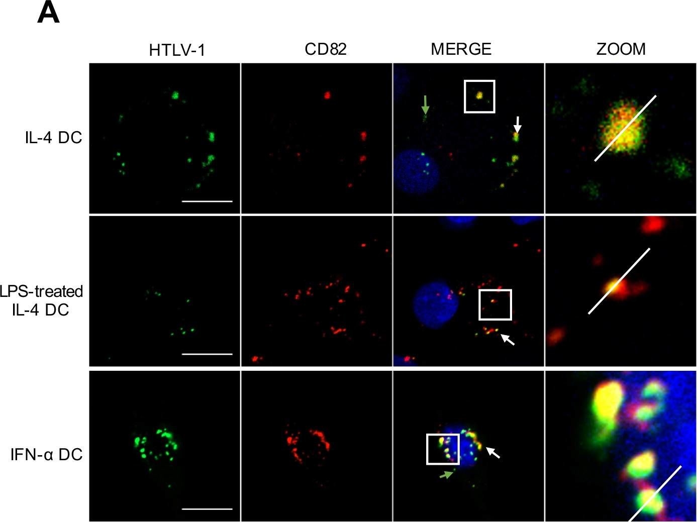 Fig.5.A showing Immunocytochemistry-immunofluorescence in a Homo sapiens (Human) sample from the publication: Dendritic cell maturation, but not type I interferon exposure, restricts infection by HTLV-1, and viral transmission to T-cells.