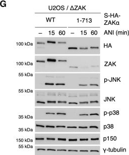 Fig.3.G showing Western Blotting in a Homo sapiens (Human) sample from the publication: Mechanism of RACK1-dependent ZAKα activation at stalled and collided ribosomes.