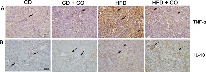 Fig.6.A showing Immunohistochemistry in a Mus musculus (House mouse) sample from the publication: Capybara Oil Improves Renal Pathophysiology and Inflammation in Obese Mice.