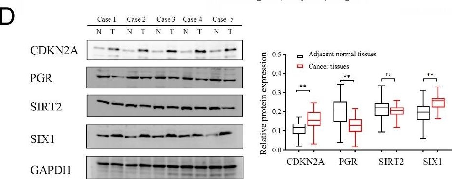 Fig.3.D showing Western Blotting in a Homo sapiens (Human) sample from the publication: An EMT-related genes signature as a prognostic biomarker for patients with endometrial cancer.