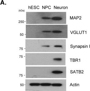 Fig.1.A showing Western Blotting from the publication: Higher Purity of Phosphatidylserine Improves Human Cortical Neuron Function by Modulating SIRT1-PGC-1α Pathways.