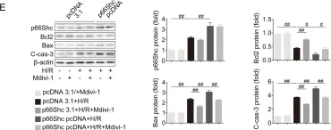Fig.2.E showing Western Blotting from the publication: USP15 regulates p66Shc stability associated with Drp1 activation in liver ischemia/reperfusion.