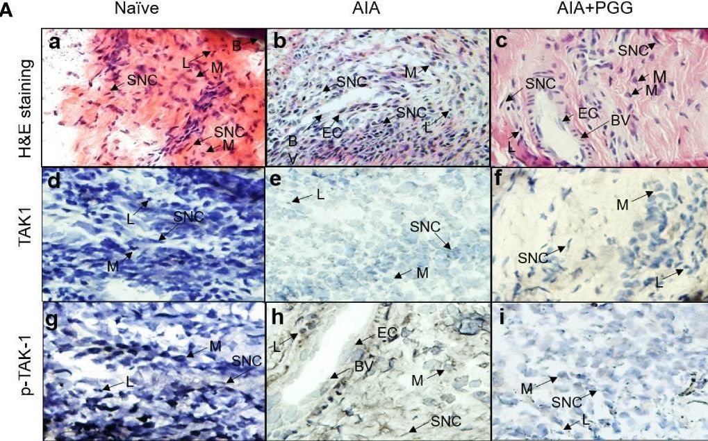 Fig.6.A showing Immunohistochemistry in a Rattus norvegicus (Rat) sample from the publication: Penta-o-galloyl-beta-d-Glucose (PGG) inhibits inflammation in human rheumatoid arthritis synovial fibroblasts and rat adjuvant-induced arthritis model.