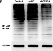 Fig.6.F showing Western Blotting in a Mus musculus (House mouse) sample from the publication: Zoledronic acid promotes osteoclasts ferroptosis by inhibiting FBXO9-mediated p53 ubiquitination and degradation.