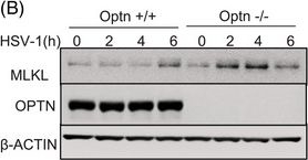 Fig.1.B showing Western Blotting in a Homo sapiens (Human) sample from the publication: MLKL‒OPTN axis regulates herpesvirus-induced neurological sequelae.