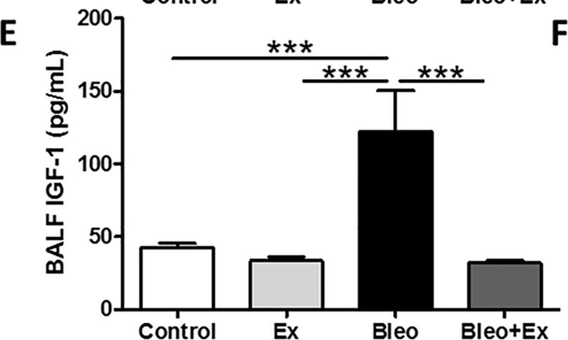 Fig.3.E showing Enzyme-linked immunosorbent assay from the publication: Aerobic Exercise Attenuated Bleomycin-Induced Lung Fibrosis in Th2-Dominant Mice.