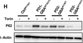 Fig.6.H showing Western Blotting from the publication: Deregulation of mTORC1-TFEB axis in human iPSC model of GBA1-associated Parkinson's disease.