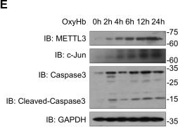 Fig.2.E showing Western Blotting in a Mus musculus (House mouse) sample from the publication: METTL3 inhibition alleviates neuroinflammation and apoptosis by reducing ETV4 m6A modification.