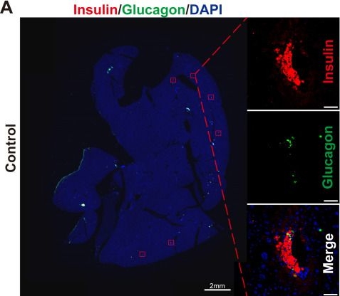 Fig.7.A showing Immunohistochemistry-immunofluorescence from the publication: Xuebijing injection mitigates instant blood-mediated inflammatory reaction and enhances intrahepatic islet transplantation via target NF-κB pathway.