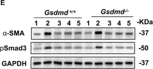 Fig.7.E showing Western Blotting in a Mus musculus (House mouse) sample from the publication: GSDMD-dependent neutrophil extracellular traps promote macrophage-to-myofibroblast transition and renal fibrosis in obstructive nephropathy.
