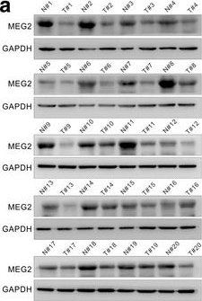 Fig.1.A showing Western Blotting in a Homo sapiens (Human) sample from the publication: MEG2 is regulated by miR-181a-5p and functions as a tumour suppressor gene to suppress the proliferation and migration of gastric cancer cells.