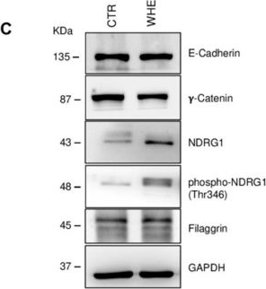 Fig.5.C showing Western Blotting in a Homo sapiens (Human) sample from the publication: Phytochemistry and Biological Effects of the Juglans regia "Sorrento" Walnut Husk Extract on Human Keratinocyte Cells.