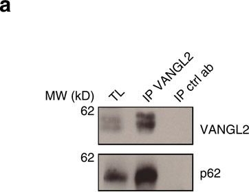 Identification of p62/SQSTM1 as a component of non-canonical Wnt VANGL2-JNK signalling in breast cancer.
