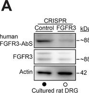 Fig.5.A showing Western Blotting in a Rattus norvegicus (Rat) sample from the publication: Pathogenic Role of FGFR3 Autoantibodies in Small Fiber Neuropathy.